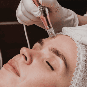 Drenaje linfatico - LiftSpa