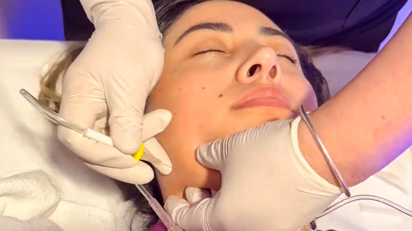 Carboxiterapia en Satélite - Lift Spa